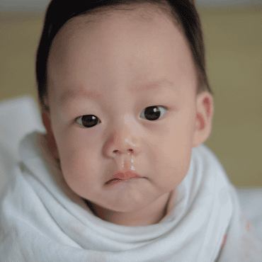 อาการแบบไหนเสี่ยงเป็น ‘โรคไซนัสอักเสบ’ ในเด็ก เช็กด่วน!