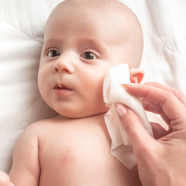 Insight Story Mothers Should Know! Rash and Skin Allergy