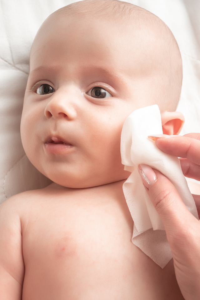 Insight Story Mothers Should Know! Rash and Skin Allergy