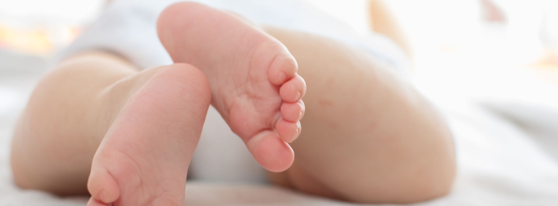 Is it true that disposable diapers cause physiologic bow legs?