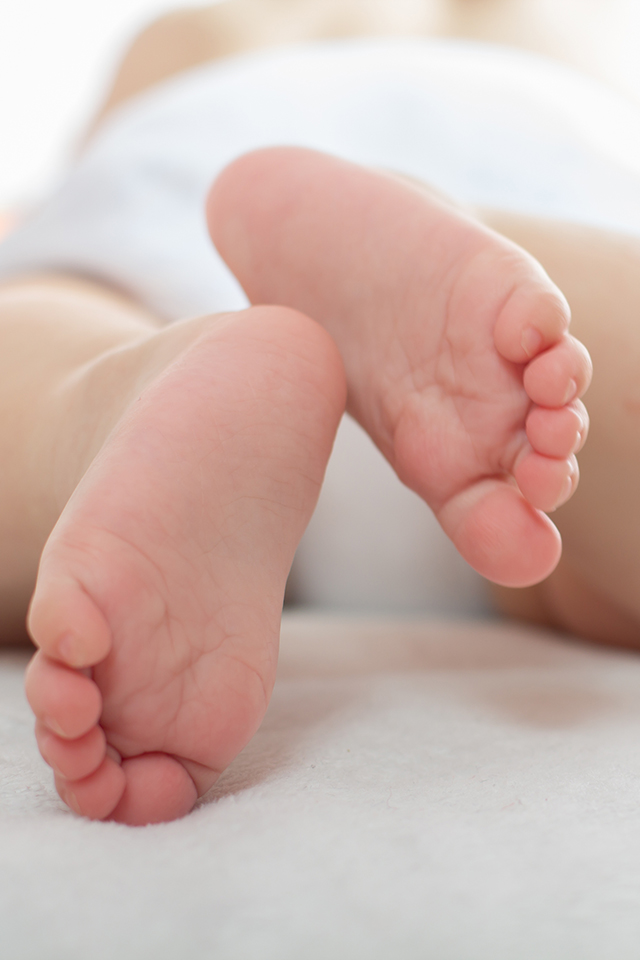 Is it true that disposable diapers cause physiologic bow legs?